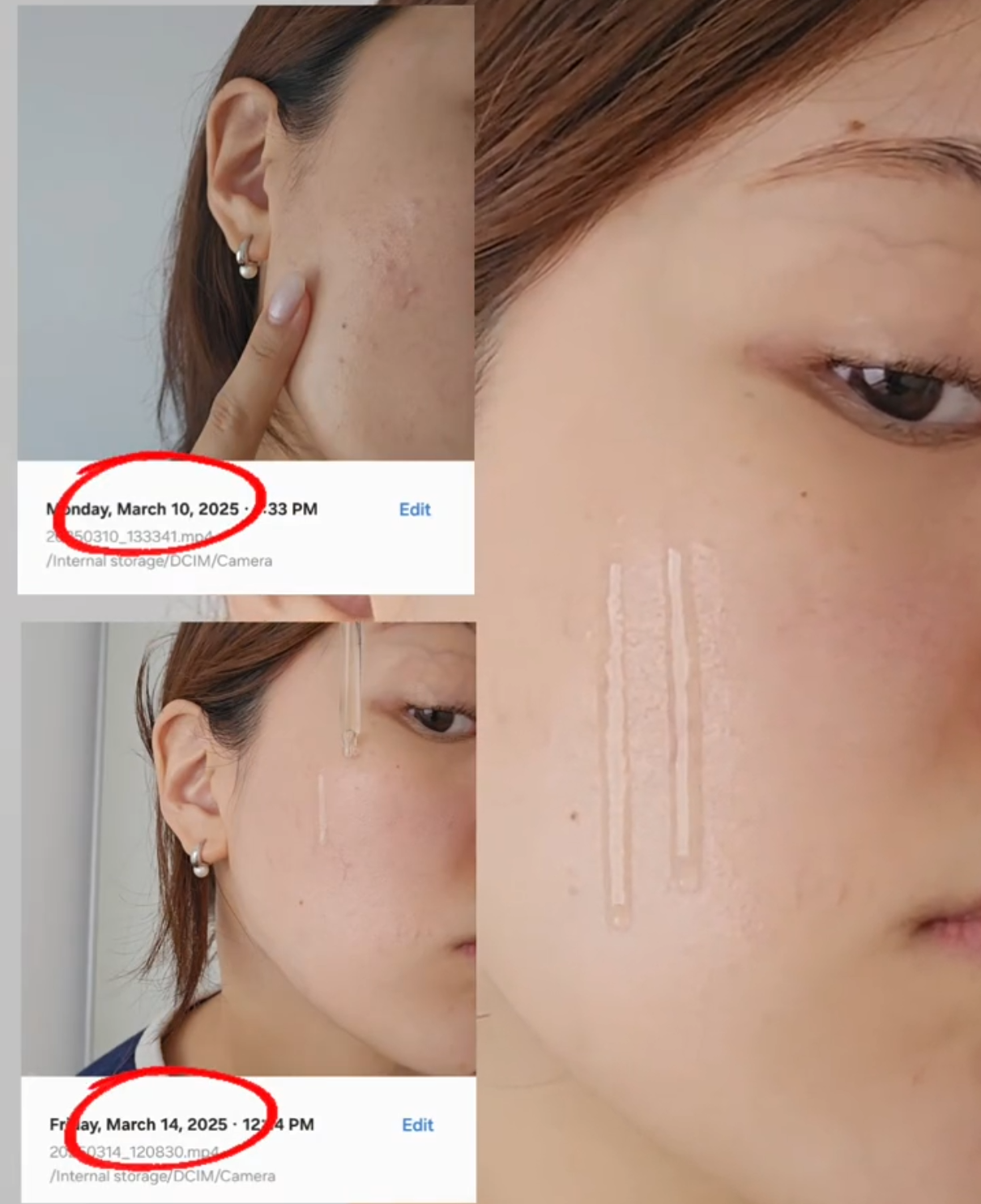 ¿Brotes de repente? Esto es lo que usó Tati