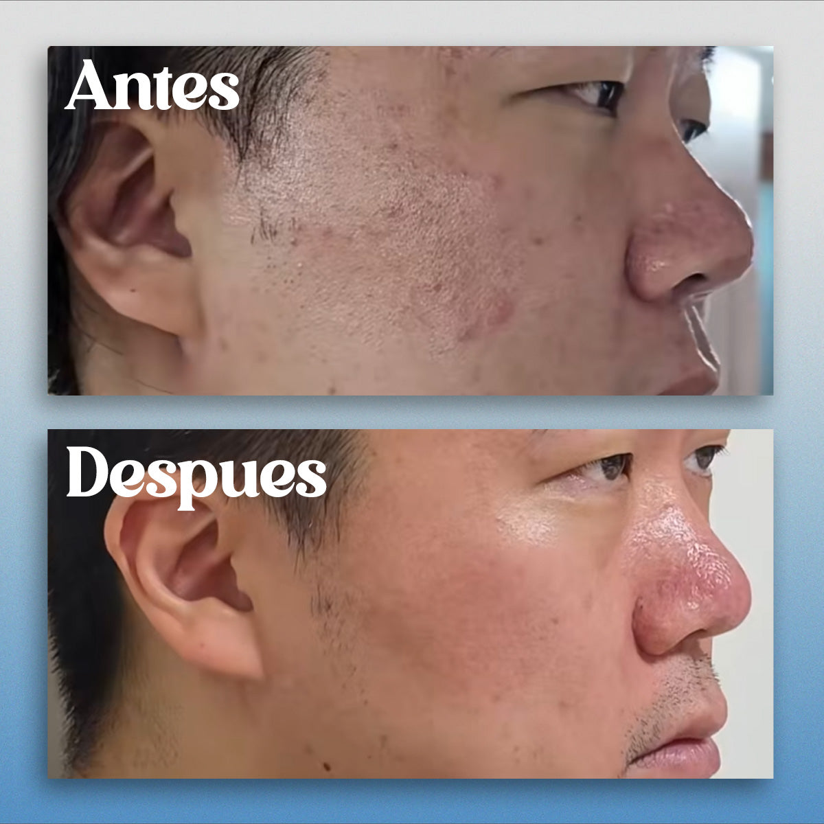 La rutina de skincare de El Mascoto