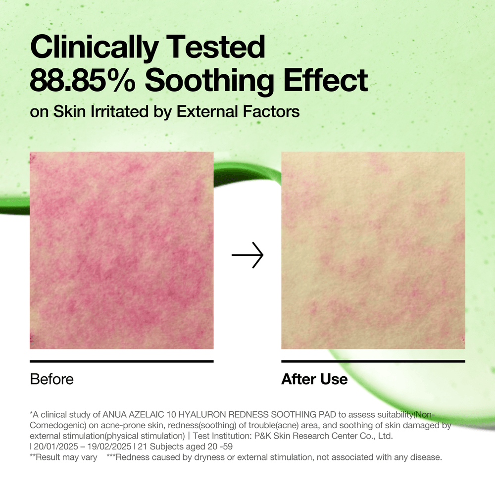 [Anua] Azelaic 10 Hyaluron Redness Soothing Pad 90ea