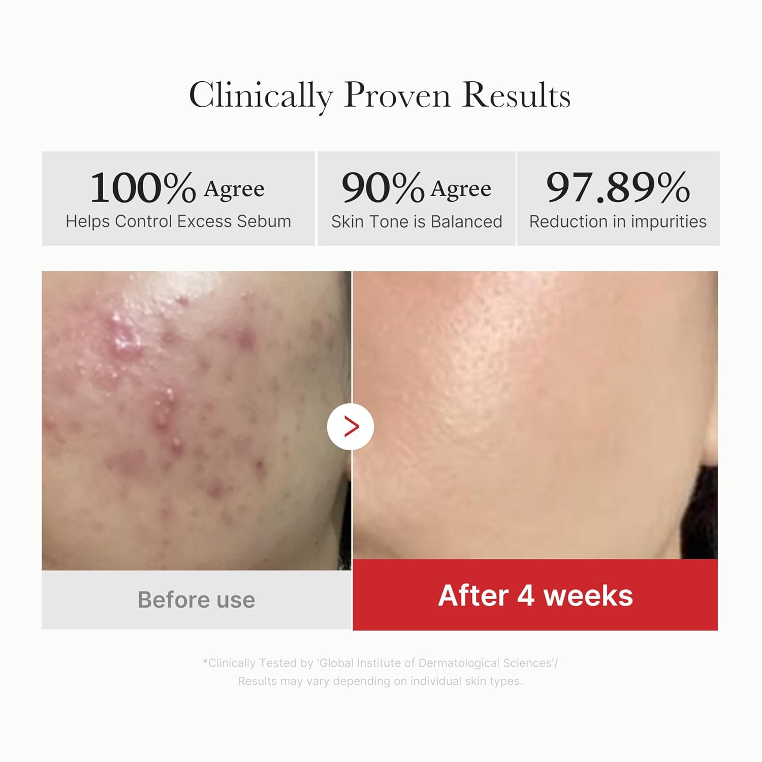 [Medicube] Discos Exfoliantes con Ácido Succínico Rojo 70 unidades